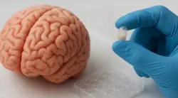 علماء يطورون كبسولات لعلاج التهاب الدماغ وألزهايمر